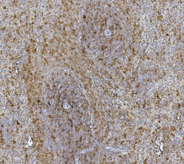 2 - Anti-Hsc70 Antibody Picoband™(monoclonal, 3B6) ABO14915