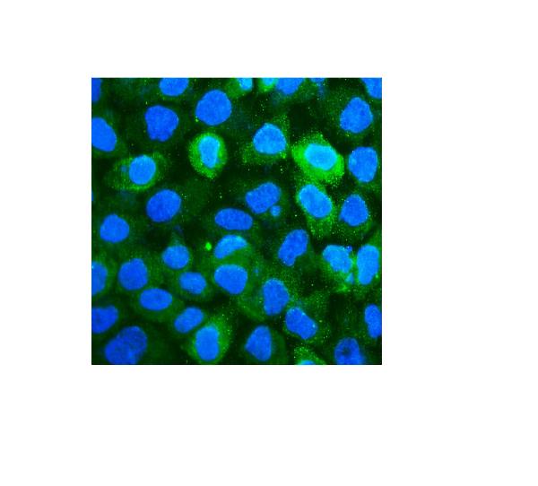 3 - Anti-CD59 Antibody Picoband™(monoclonal, 3C10) ABO14916