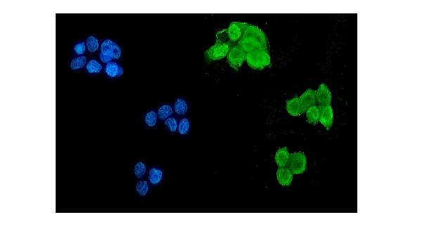 3 - Anti-Musashi 1/Msi1 Antibody (monoclonal, 2B9) ABO14917