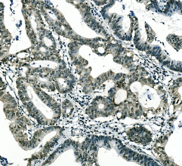 2 - Anti-Musashi 1/Msi1 Antibody (monoclonal, 2B9) ABO14917