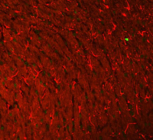 3 - Anti-GFAP Antibody Picoband™ (monoclonal, 3F2) ABO14918