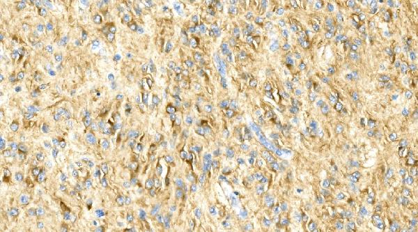 2 - Anti-GFAP Antibody Picoband™ (monoclonal, 3F2) ABO14918