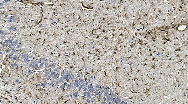 2 - Anti-GFAP Antibody Picoband™ (monoclonal, 3F2) ABO14918