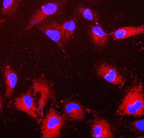 3 - Anti-PRDX6 Antibody Picoband™ (monoclonal, 6I8) ABO14925