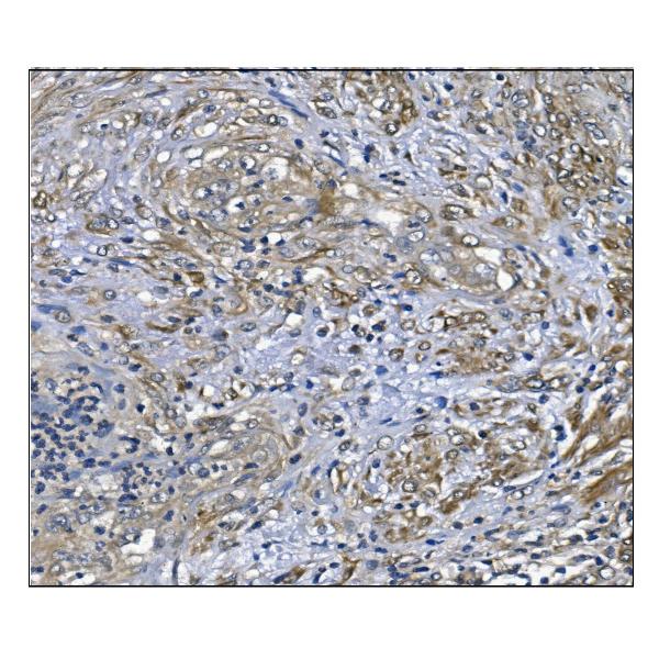 2 - Anti-PRDX6 Antibody Picoband™ (monoclonal, 6I8) ABO14925