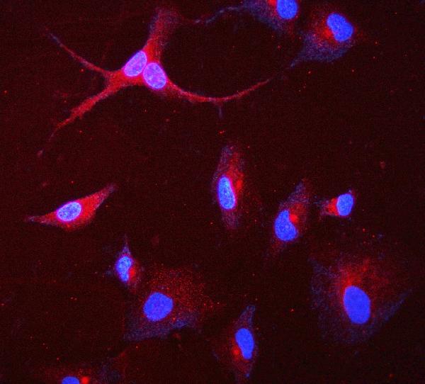 3 - Anti-GAA Antibody Picoband™ (monoclonal, 2G7) ABO14926