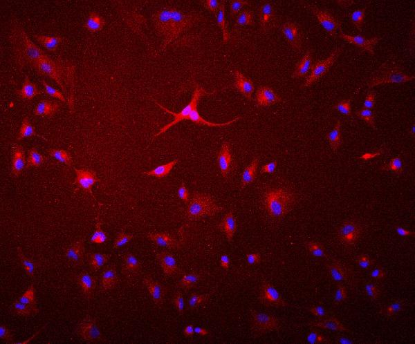 3 - Anti-GAA Antibody Picoband™ (monoclonal, 2G7) ABO14926