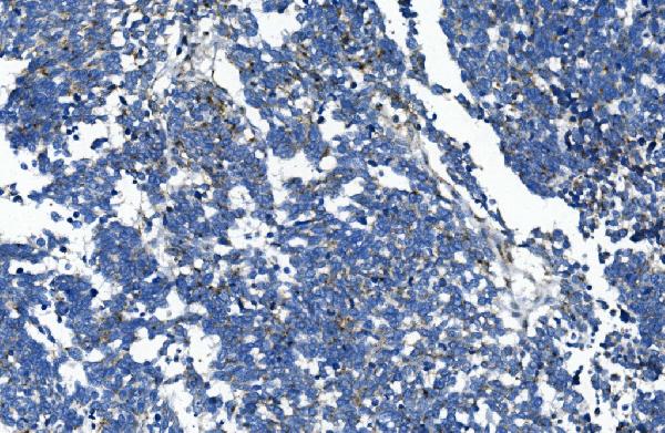 2 - Anti-GAA Antibody Picoband™ (monoclonal, 2G7) ABO14926