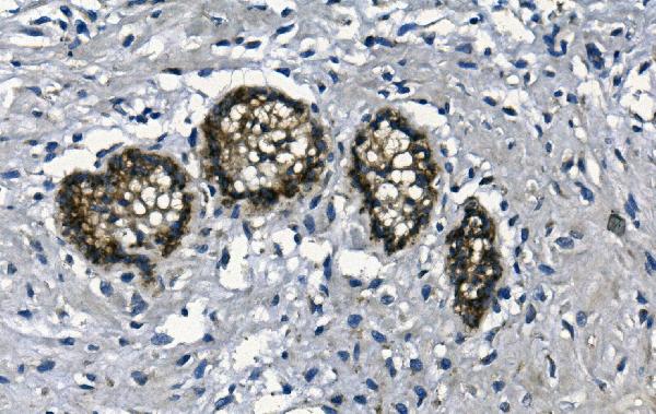2 - Anti-GAA Antibody Picoband™ (monoclonal, 2G7) ABO14926