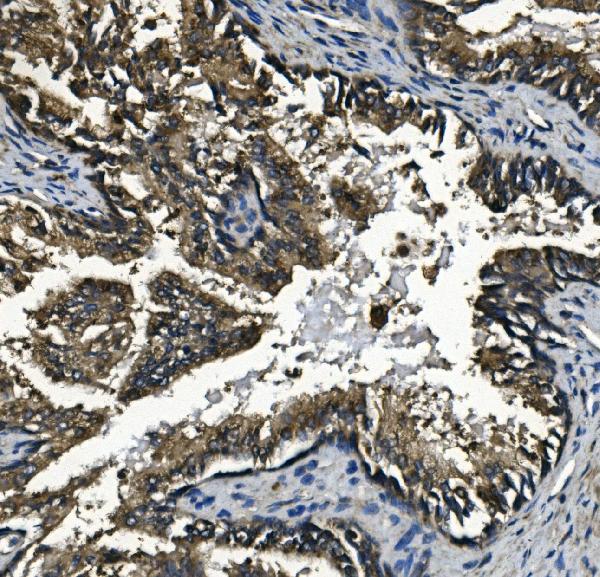 2 - Anti-GAA Antibody Picoband™ (monoclonal, 2G7) ABO14926