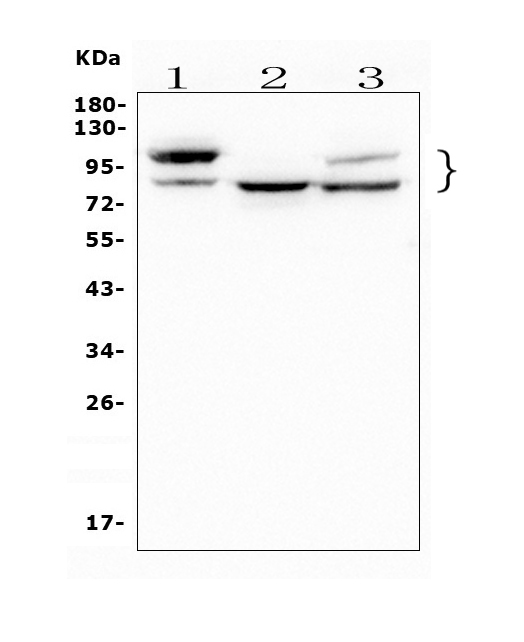 1 - Anti-GAA Antibody Picoband™ (monoclonal, 2G7) ABO14926