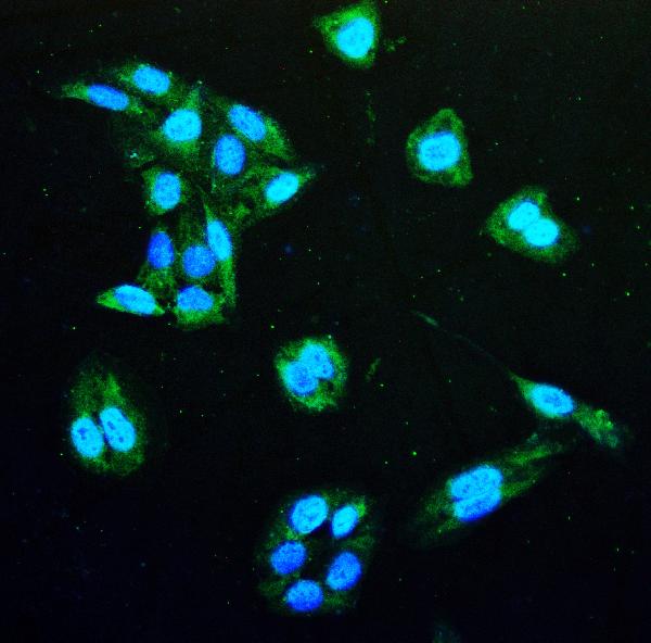 3 - Anti-IDH1 Antibody Picoband™ (monoclonal, 16H7) ABO14927