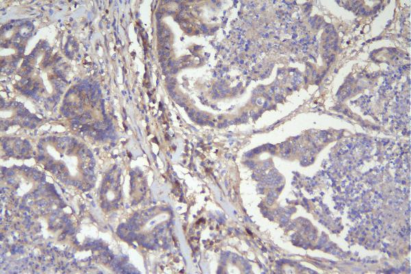 2 - Anti-CD46 Antibody Picoband™ (monoclonal, 9E9) ABO14932