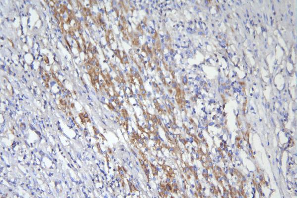 2 - Anti-CD46 Antibody Picoband™ (monoclonal, 9E9) ABO14932