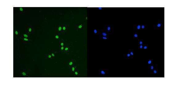 3 - Anti-KAP1/TRIM28 Antibody Picoband™ (monoclonal, 3H2) ABO14933