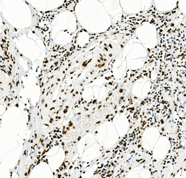 2 - Anti-KAP1/TRIM28 Antibody Picoband™ (monoclonal, 3H2) ABO14933