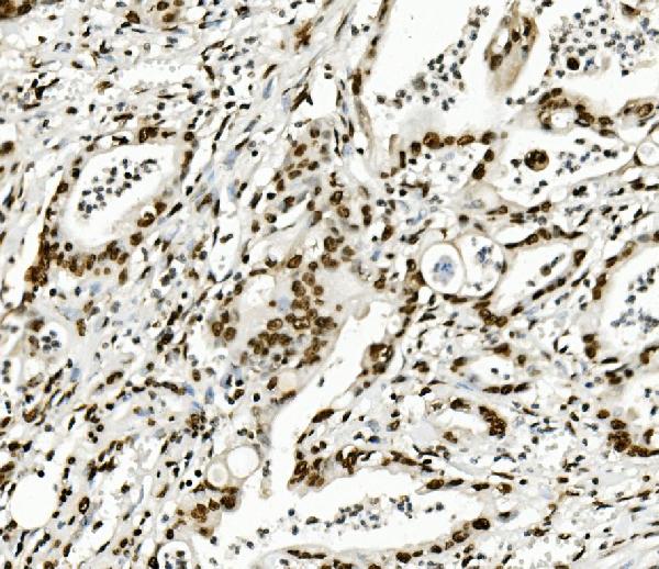 2 - Anti-KAP1/TRIM28 Antibody Picoband™ (monoclonal, 3H2) ABO14933
