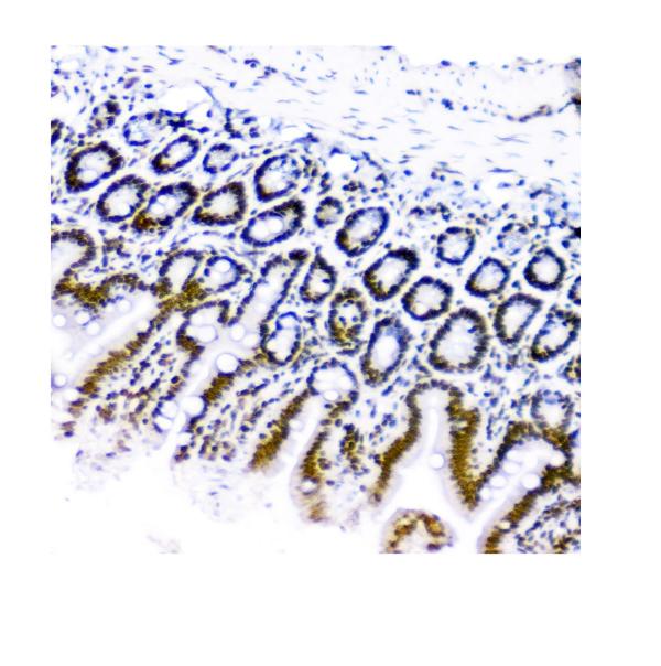 2 - Anti-KAP1/TRIM28 Antibody Picoband™ (monoclonal, 3H2) ABO14933