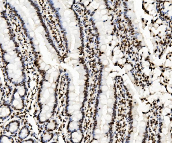 2 - Anti-KAP1/TRIM28 Antibody Picoband™ (monoclonal, 3H2) ABO14933