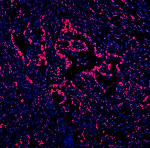 3 - Anti-DDX5 Antibody Picoband™ (monoclonal, 3F9) ABO14935