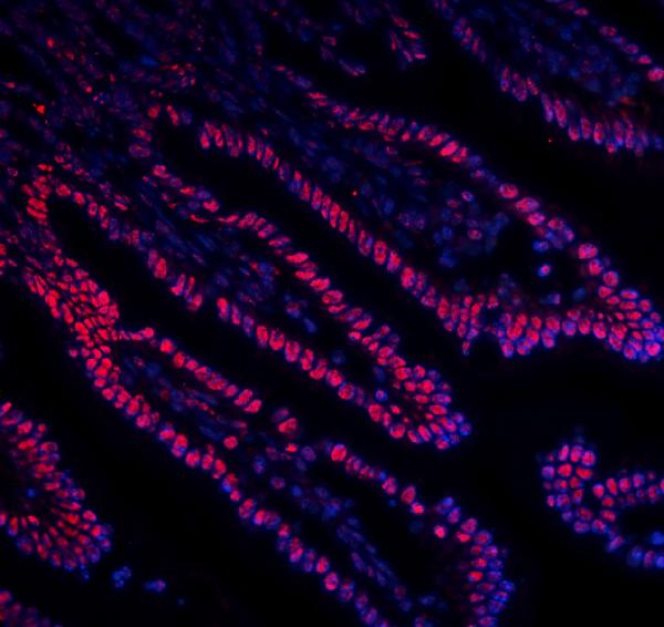 3 - Anti-DDX5 Antibody Picoband™ (monoclonal, 3F9) ABO14935