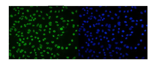 3 - Anti-DDX5 Antibody Picoband™ (monoclonal, 3F9) ABO14935