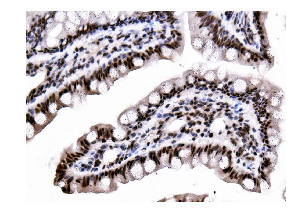 2 - Anti-DDX5 Antibody Picoband™ (monoclonal, 3F9) ABO14935
