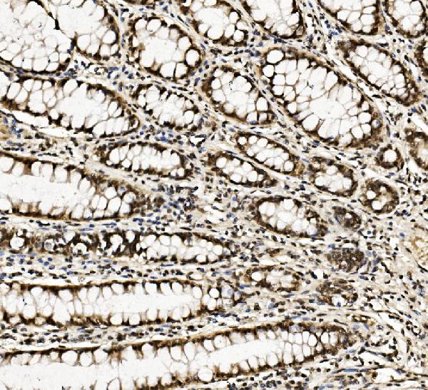 2 - Anti-DDX5 Antibody Picoband™ (monoclonal, 3F9) ABO14935