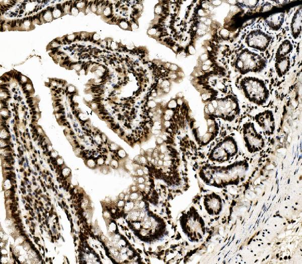 2 - Anti-DDX5 Antibody Picoband™ (monoclonal, 3F9) ABO14935