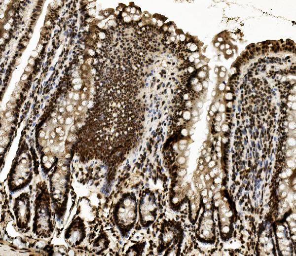 2 - Anti-DDX5 Antibody Picoband™ (monoclonal, 3F9) ABO14935