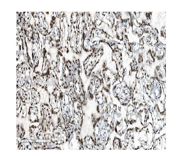 2 - Anti-DDX5 Antibody Picoband™ (monoclonal, 3F9) ABO14935
