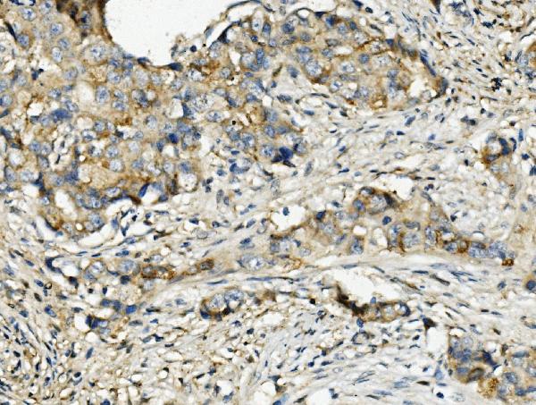 2 - Anti-Ribonuclease Inhibitor/RNH1 Antibody Picoband™ (monoclonal, 4F3) ABO14936