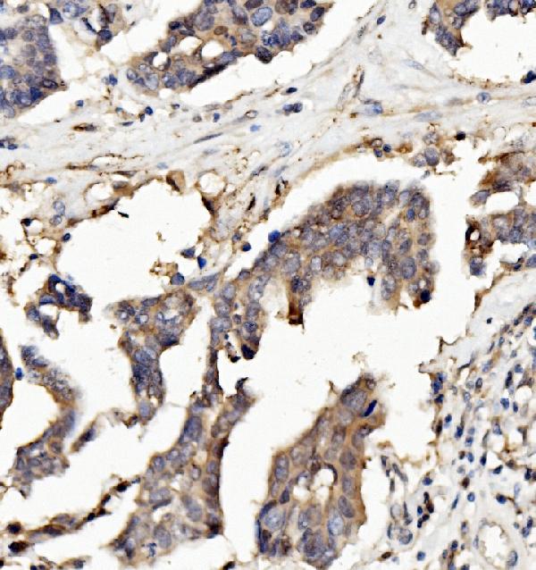 2 - Anti-Ribonuclease Inhibitor/RNH1 Antibody Picoband™ (monoclonal, 4F3) ABO14936