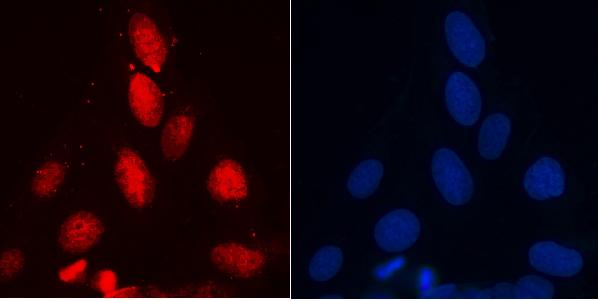 3 - Anti-RENT1/hUPF1 Antibody Picoband™ (monoclonal, 11E7) ABO14937