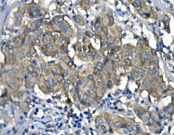 2 - Anti-RENT1/hUPF1 Antibody Picoband™ (monoclonal, 11E7) ABO14937