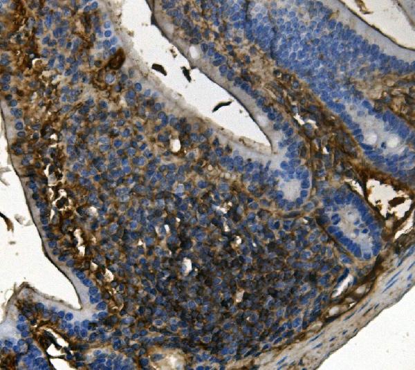 2 - Anti-RENT1/hUPF1 Antibody Picoband™ (monoclonal, 11E7) ABO14937