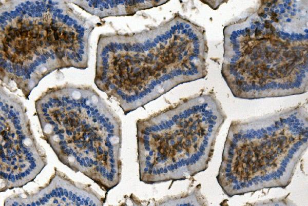 2 - Anti-RENT1/hUPF1 Antibody Picoband™ (monoclonal, 11E7) ABO14937