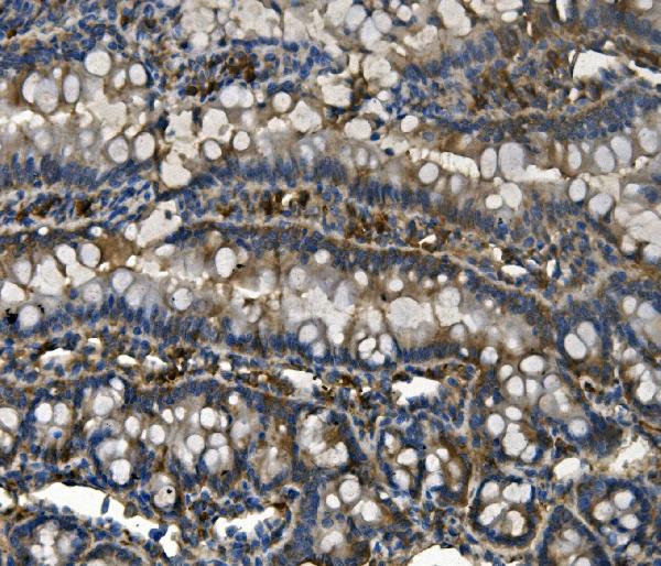 2 - Anti-RENT1/hUPF1 Antibody Picoband™ (monoclonal, 11E7) ABO14937