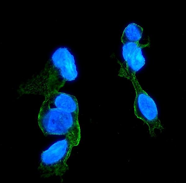 3 - Anti-CCR2 Antibody Picoband™ (monoclonal, 8C4) ABO14938