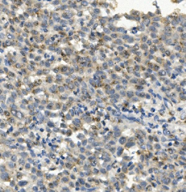2 - Anti-CCR2 Antibody Picoband™ (monoclonal, 8C4) ABO14938