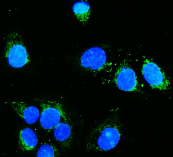 3 - Anti-Hexokinase 1/HK1 Antibody Picoband™ (monoclonal, 2I4) ABO14939