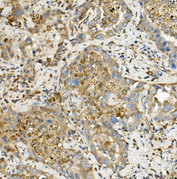 2 - Anti-Hexokinase 1/HK1 Antibody Picoband™ (monoclonal, 2I4) ABO14939