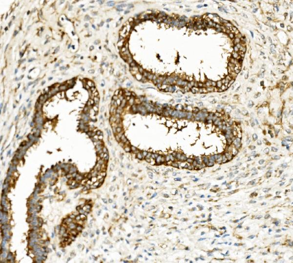2 - Anti-Hexokinase 1/HK1 Antibody Picoband™ (monoclonal, 2I4) ABO14939