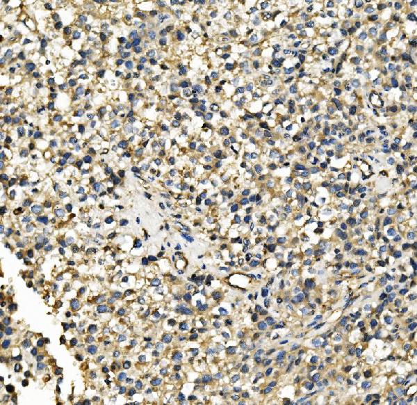 2 - Anti-Hexokinase 1/HK1 Antibody Picoband™ (monoclonal, 2I4) ABO14939