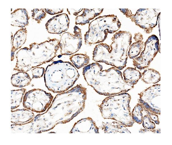 2 - Anti-Hexokinase 1/HK1 Antibody Picoband™ (monoclonal, 2I4) ABO14939