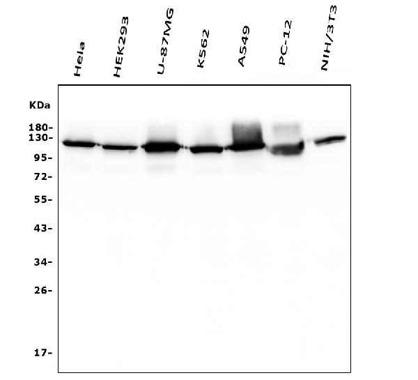 1 - Anti-Hexokinase 1/HK1 Antibody Picoband™ (monoclonal, 2I4) ABO14939