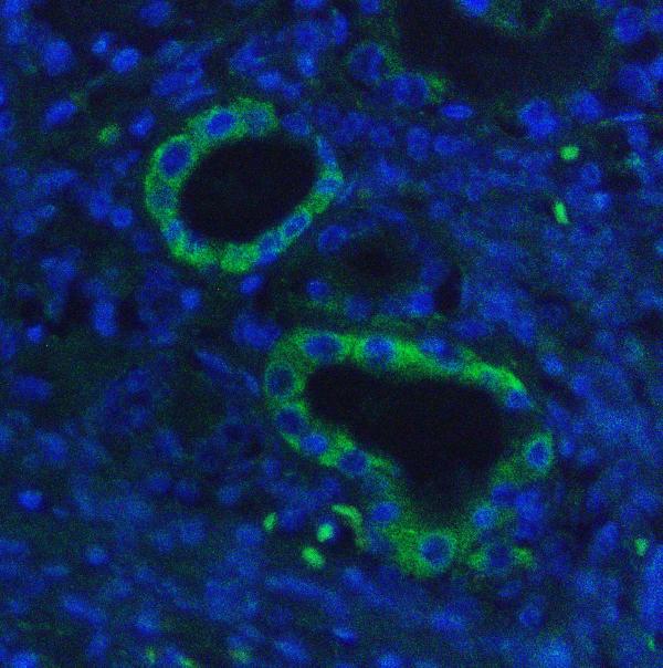 3 - Anti-Hexokinase 1/HK1 Antibody Picoband™ (monoclonal, 4B7) ABO14940