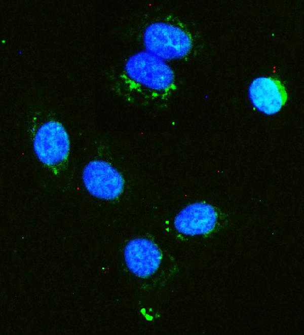 3 - Anti-Hexokinase 1/HK1 Antibody Picoband™ (monoclonal, 4B7) ABO14940