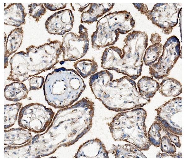 2 - Anti-Hexokinase 1/HK1 Antibody Picoband™ (monoclonal, 4B7) ABO14940