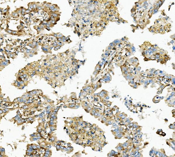 2 - Anti-Hexokinase 1/HK1 Antibody Picoband™ (monoclonal, 4B7) ABO14940
